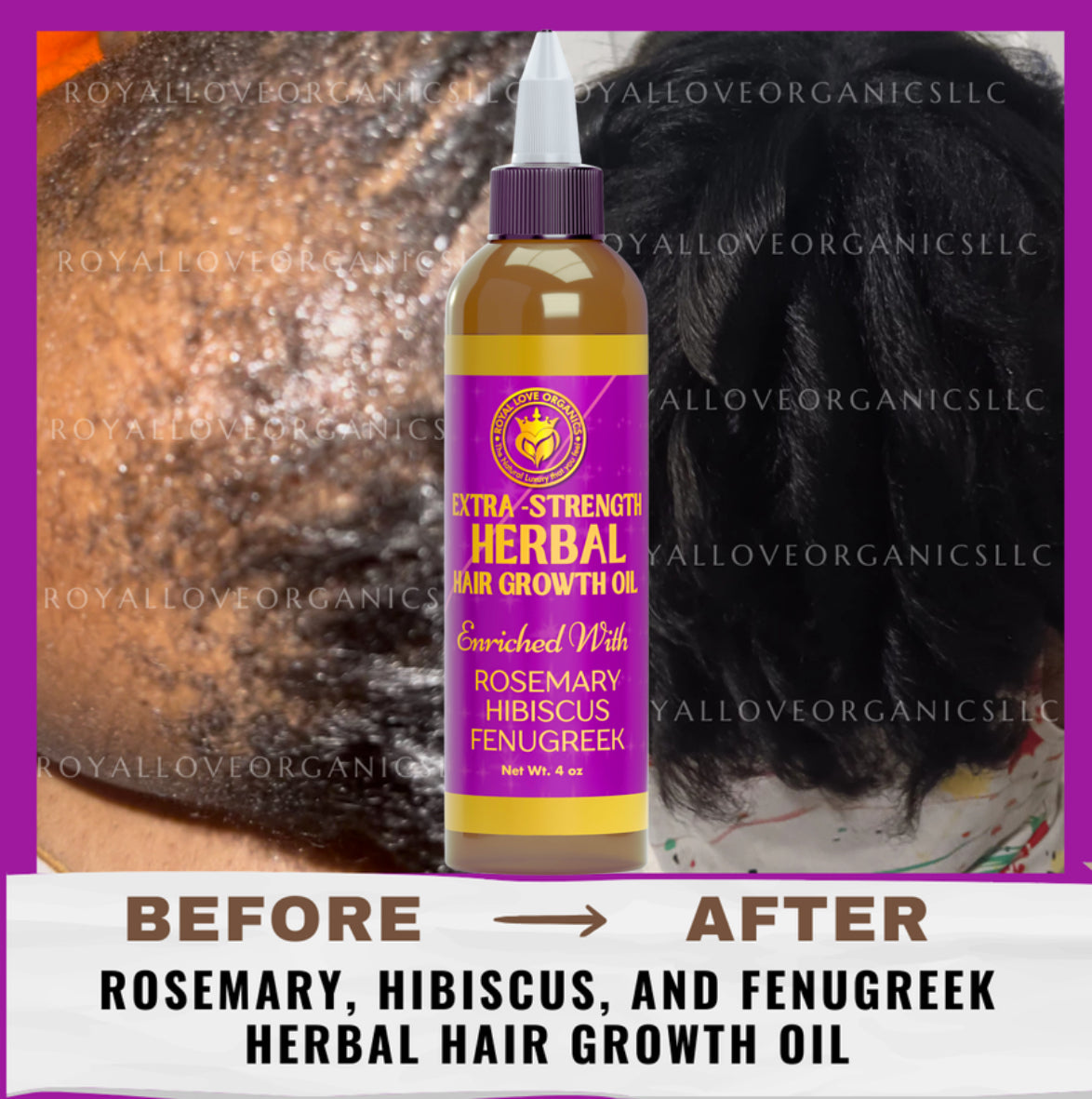 Rosemary+Fenugreek+Hibiscus Herbal Hair Growth Oil | Extra Strength